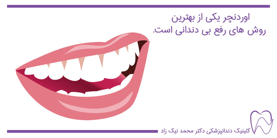 اوردنچر دندان