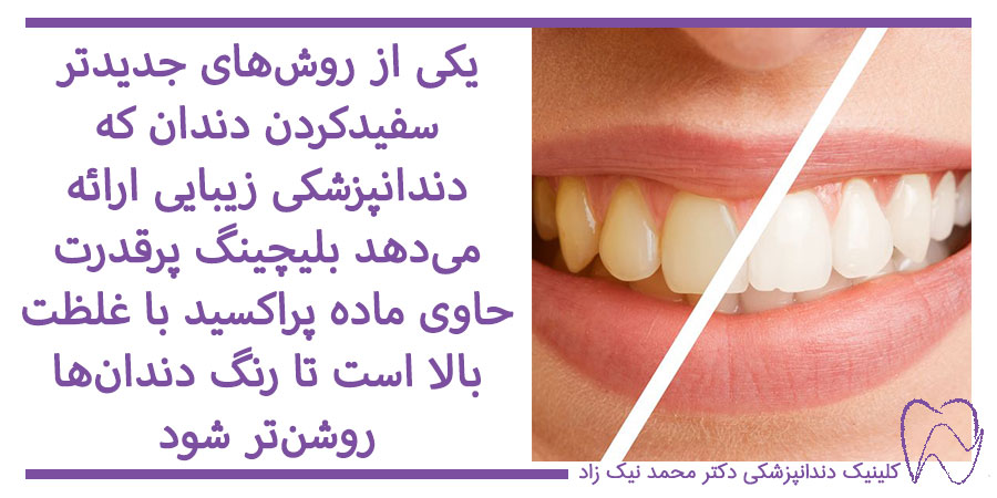 روش جدید بلیچینگ دندان