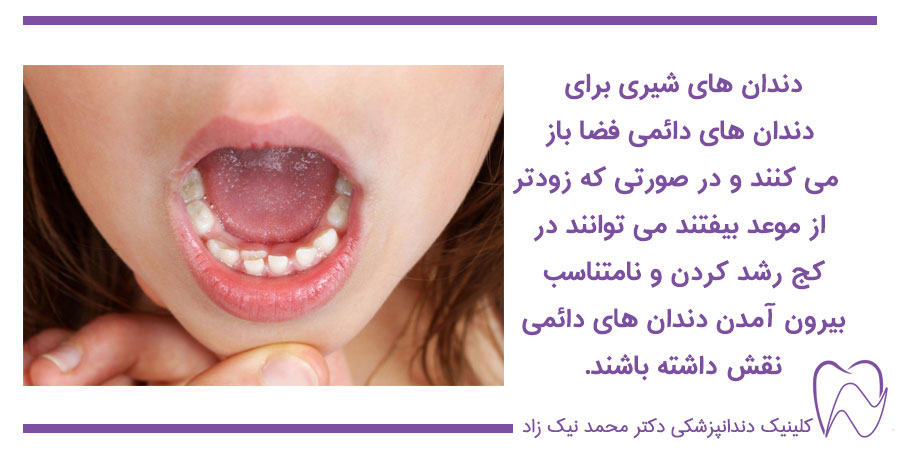 دندان های شیری