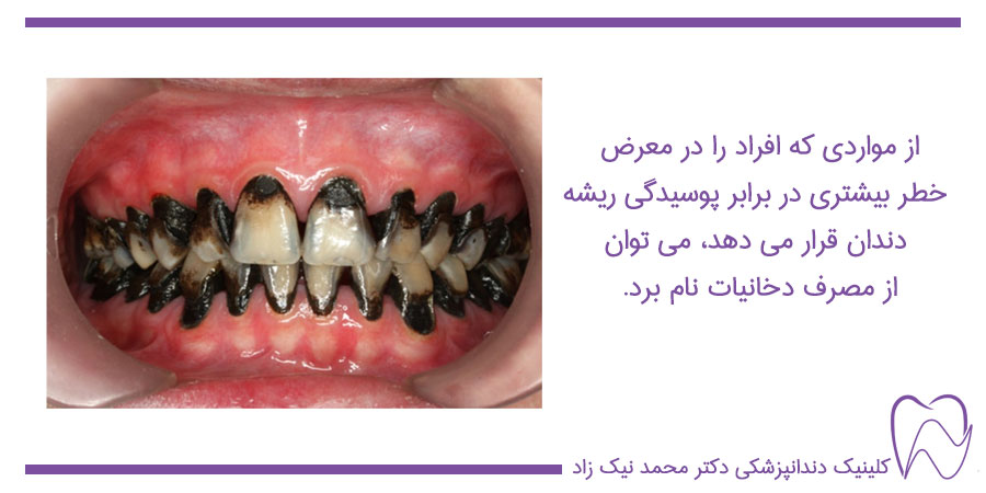 علائم پوسیدگی دندان