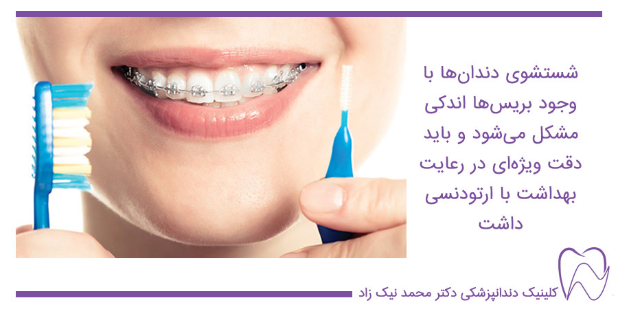 شست و شوی صحیح ارتودنسی دندان