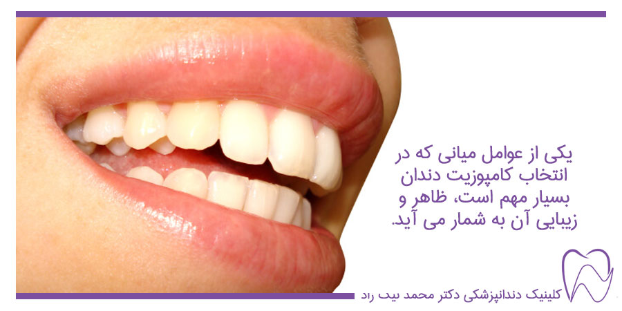 ویژگی های کامپوزیت دندان