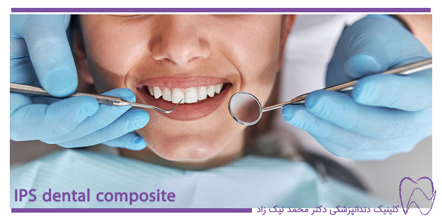 کامپوزیت دندان ips