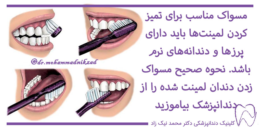 روش صحیح مسواک زدن دندان