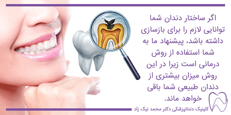 بیلدآپ و بازسازی دندان