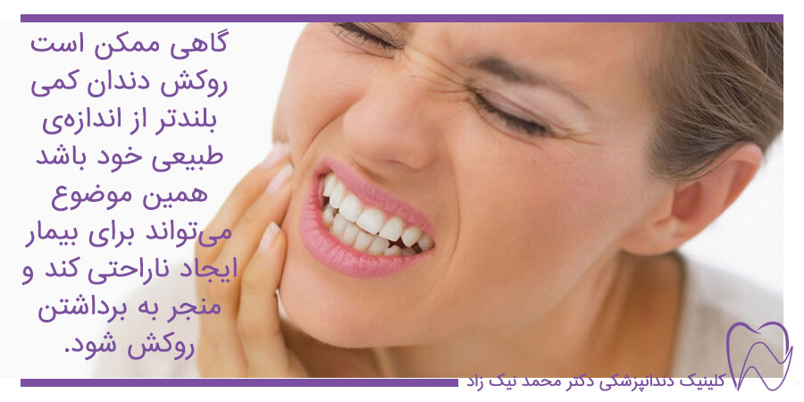 درد دندان زیر روکش