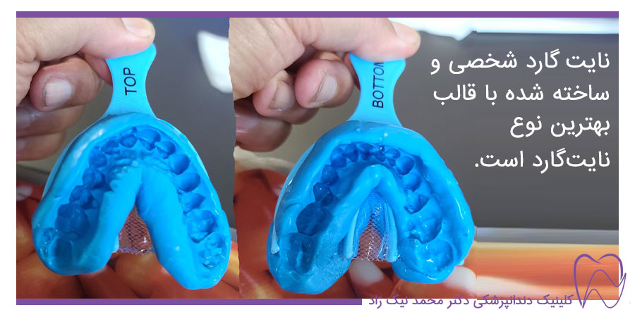 قالب گیری برای محافظ دندان