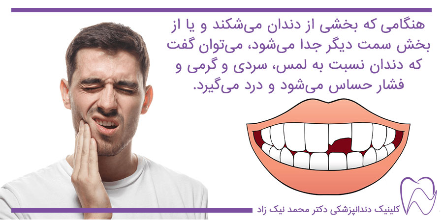 دندان درد بر اثر شکستن دندان