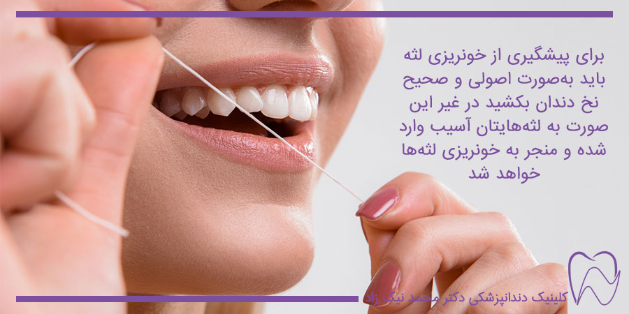 طرز صحیح نخ دندان کشیدن