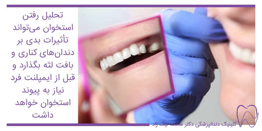 روش‌های جایگزین دندان