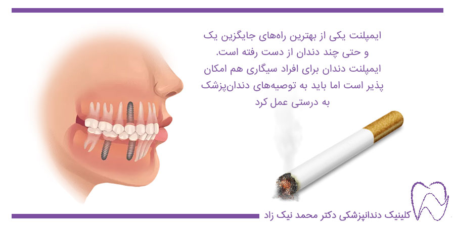 ایمپلنت دندان برای افراد سیگاری
