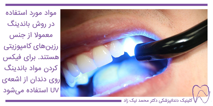 مراحل باندینگ دندان