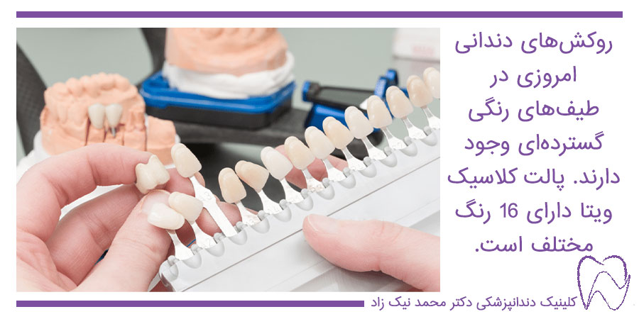 راهنمای انتخاب رنگ روکش دندان با پالت ویتا