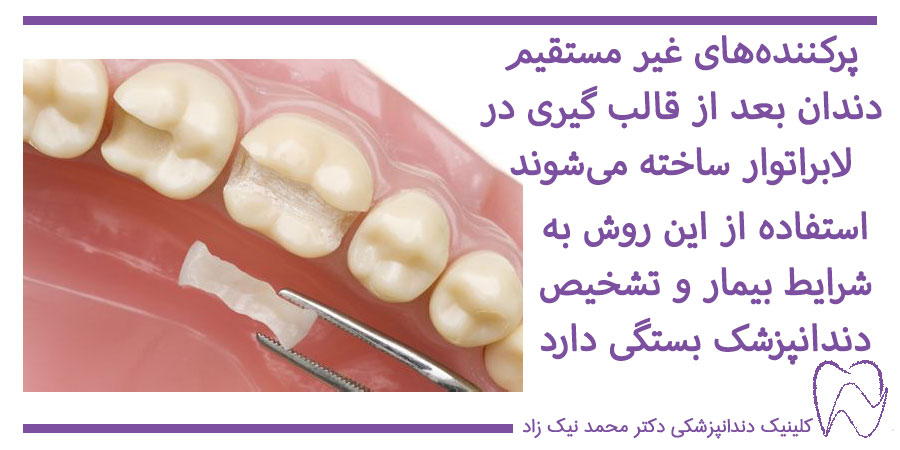 پر کردن غیر مستقیم دندان